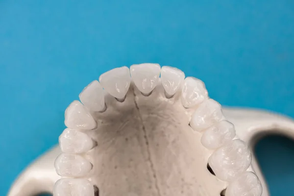 青い背景に分離された歯の解剖学的モデルを持つ上顎 健康な歯 歯のケアと歯列矯正医療の概念 高品質の写真 — ストック写真