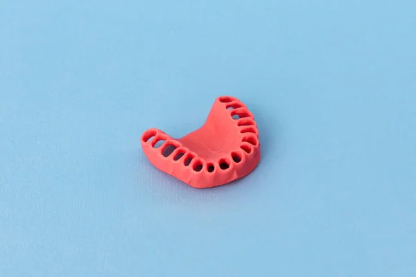 Lidské Dásně Bez Zubů Model Lékařského Implantátu Izolované Modrém Pozadí — Stock fotografie