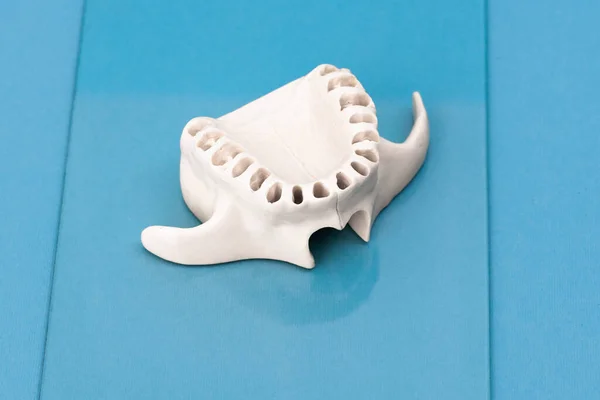 Oberkiefer Ohne Zähne Modell Medizinisches Implantat Isoliert Auf Blauem Hintergrund — Stockfoto