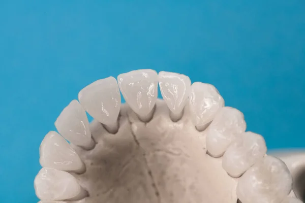 Mascella Umana Superiore Con Modello Anatomico Dei Denti Isolato Sfondo — Foto Stock