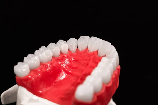 歯の解剖学的モデルを持つ低人間の顎は黒の背景に隔離された 健康な歯 歯のケアと歯列矯正医療の概念 高品質の写真 — ストック写真