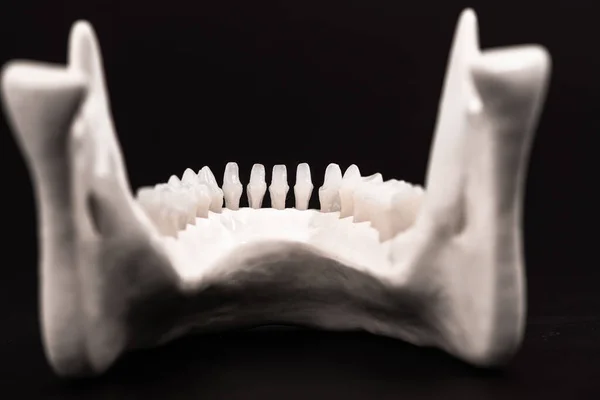 Mandíbula Humana Inferior Com Modelo Anatomia Dos Dentes Isolado Fundo — Fotografia de Stock