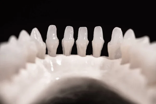 Mandíbula Humana Inferior Com Modelo Anatomia Dos Dentes Isolado Fundo — Fotografia de Stock