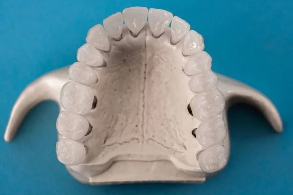 青い背景に分離された歯の解剖学的モデルを持つ上顎 健康な歯 歯のケアと歯列矯正医療の概念 高品質の写真 — ストック写真