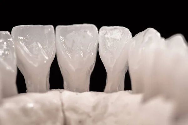 歯の解剖学的モデルを持つ低人間の顎は黒の背景に隔離された 健康な歯 歯のケアと歯列矯正医療の概念 高品質の写真 — ストック写真