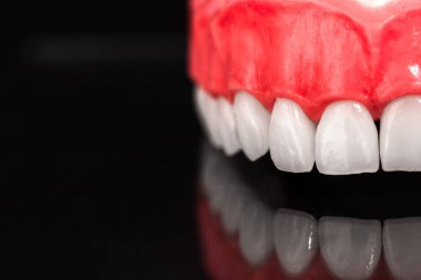 Diş anatomisi modeli siyah arka planda izole edilmiş insan çenesi. Sağlıklı dişler, diş bakımı ve ortodontik tıbbi konsept. Merhaba kaliteli fotoğraf.