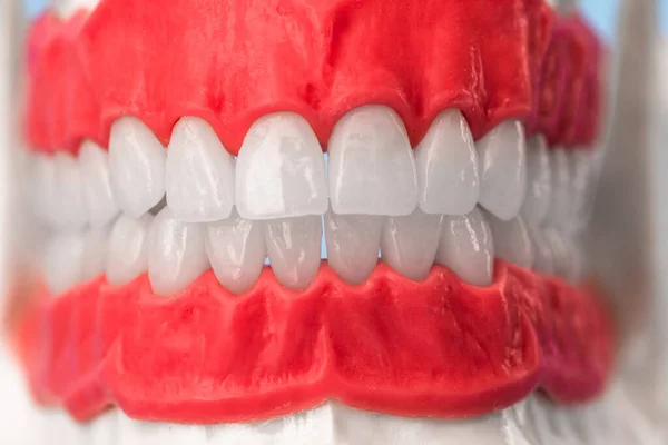 Ludzka Szczęka Zębami Dziąsłami Model Anatomiczny Izolowany Niebieskim Tle Zdrowe — Zdjęcie stockowe