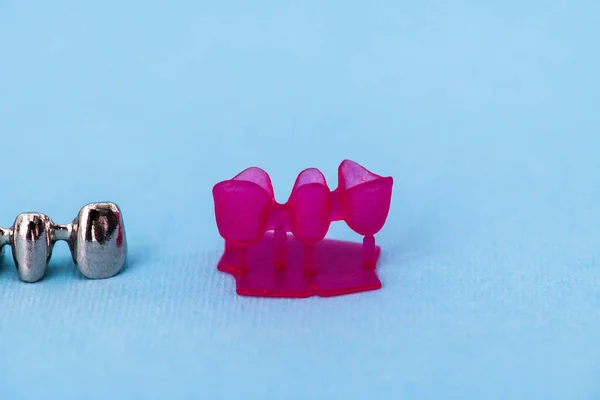 Diş Implantı Taç Yerleştirme Işlemi Parçaları Mavi Arka Planda Izole — Stok fotoğraf