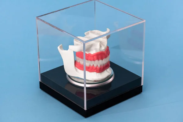 Человеческая Челюсть Имплантатами Зубов Анатомическая Модель Изолирована Синем Фоне Стеклянной — стоковое фото