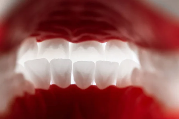 Модель Анатомії Щелепи Людини Зубами Яснами Ізольована Синьому Фоні Вид — стокове фото