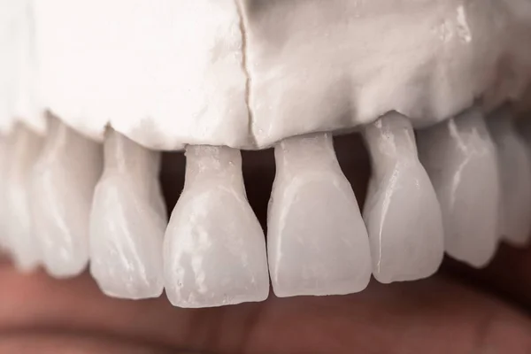 Mandíbula Humana Superior Con Modelo Anatomía Dental Aislado Sobre Fondo —  Fotos de Stock