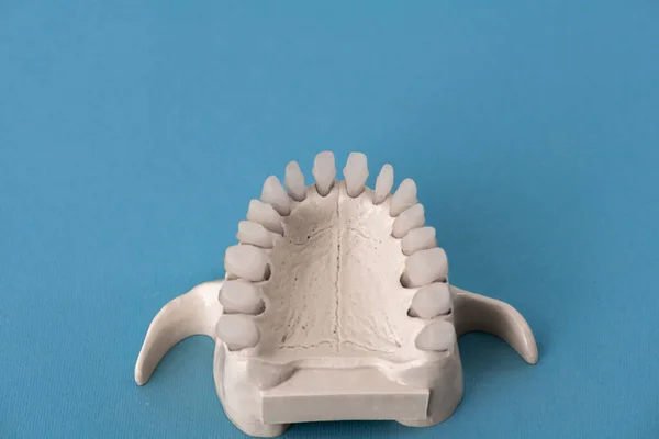 Mandíbula Humana Superior Con Modelo Anatomía Dental Aislado Sobre Fondo —  Fotos de Stock