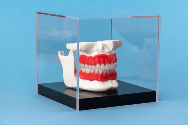 Human jaw with teeth implants anatomy model isolated on blue background in a glass box. Healthy teeth, dental care and orthodontic medical healthcare concept. Hi-quality copy space photo.