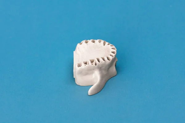 歯のない上の人間の顎は 青色の背景に隔離された医療インプラントをモデル化します 健康な歯 歯のケアと歯列矯正の概念 高品質のコピースペース — ストック写真