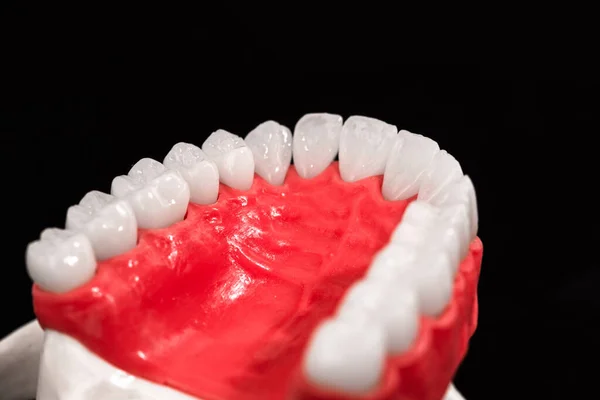 Mandíbula Humana Inferior Com Modelo Anatomia Dos Dentes Isolado Fundo — Fotografia de Stock
