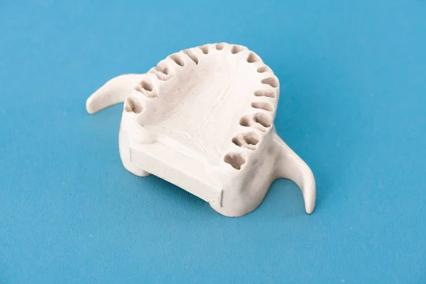 Верхня Щелепа Людини Моделі Зубів Медичний Імплантат Ізольований Синьому Фоні — стокове фото