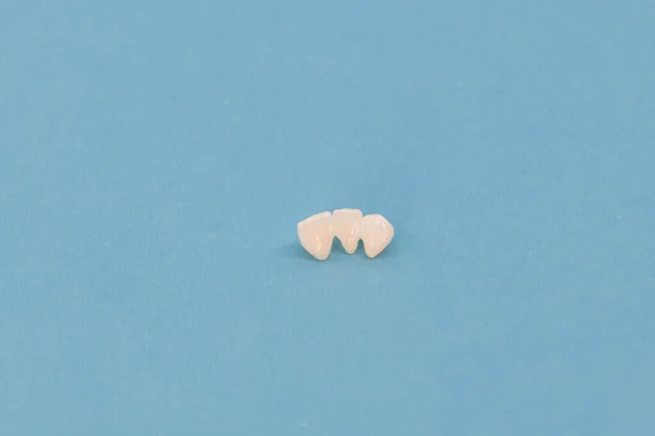 Kovové Zdarma Keramické Zuby Implantát Zubní Koruny Izolované Modrém Pozadí — Stock fotografie