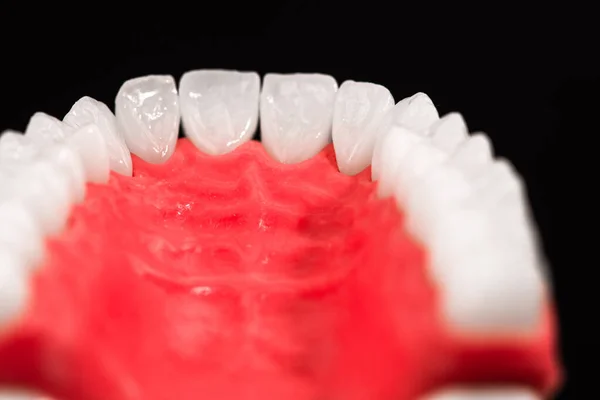 Mandíbula Humana Inferior Con Modelo Anatomía Dental Aislado Sobre Fondo — Foto de Stock