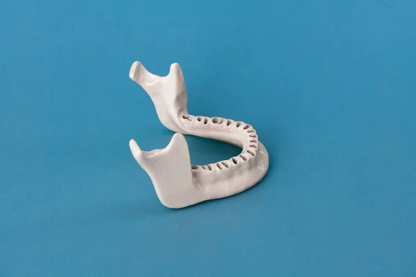Upper human jaw without teeth model medical implant isolated on blue background. Healthy teeth, dental care and orthodontic concept. Hi quality copy space.