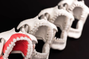 Diş hekimi ortodontik dişler siyah arka planda açılan çeneli modelleri yerleştirir. Merhaba kaliteli fotokopi alanı fotoğrafı.