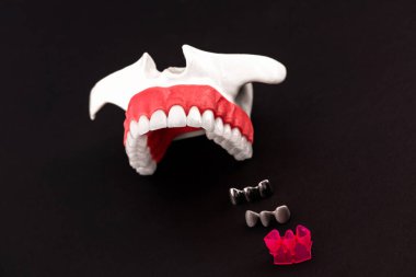 Diş implantı ve taç yerleştirme işleminin parçaları mavi arka planda izole edilir. Tıbben doğru 3D model. Merhaba kaliteli fotokopi alanı fotoğrafı. 