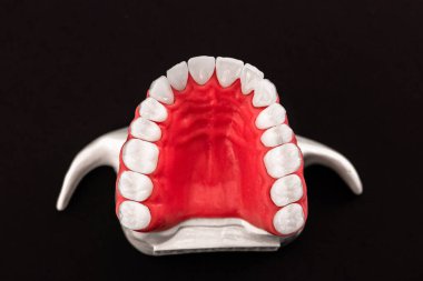 Diş implantı ve taç yerleştirme işleminin parçaları mavi arka planda izole edilir. Tıbben doğru 3D model. Merhaba kaliteli fotokopi alanı fotoğrafı. 