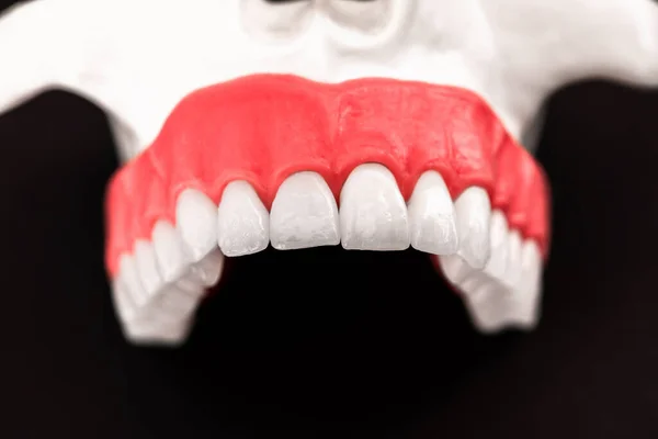 Peças Processo Instalação Implante Coroa Dos Dentes São Isoladas Fundo — Fotografia de Stock