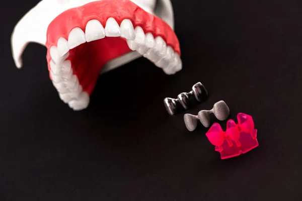 歯のインプラントとクラウンの取り付けプロセス部品は青の背景に隔離されています 医学的に正確な3Dモデル 高品質のコピースペースの写真 — ストック写真
