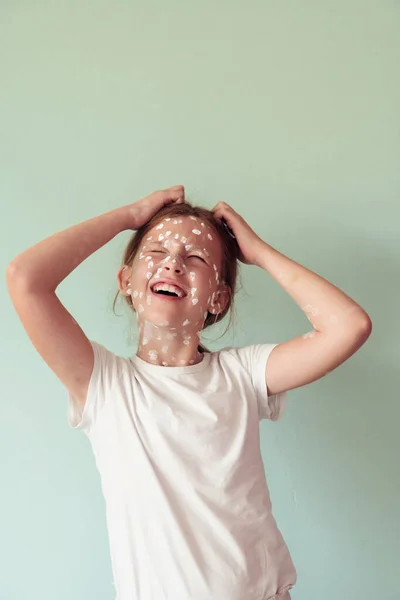 Retrato Uma Menina Escola Com Varicela Creme Séptico Aplicado Rosto — Fotografia de Stock