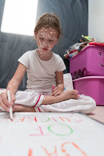 Liten Skolflicka Med Vattkoppor Ritning Vit Tavla Barnrum Antiseptisk Kräm — Stockfoto