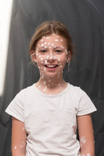 水痘を持つ小さな学校の女の子の肖像画 顔と体に適用される防腐クリーム 黒板の背景 高品質の写真 — ストック写真