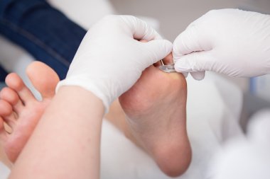 podiatrist ( chiropodist ) temizlik kadın ayakları ( ayak tırnakları )