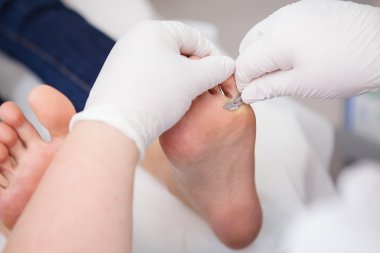 podiatrist ( chiropodist ) temizlik kadın ayakları ( ayak tırnakları )