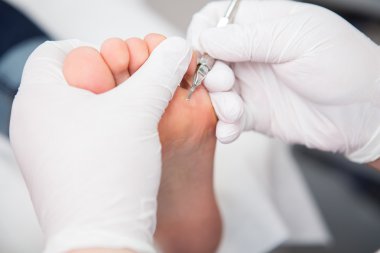 podiatrist ( chiropodist ) temizlik kadın ayakları ( ayak tırnakları )