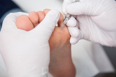 podiatrist ( chiropodist ) temizlik kadın ayakları ( ayak tırnakları )