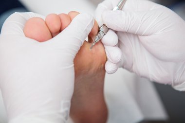 podiatrist ( chiropodist ) temizlik kadın ayakları ( ayak tırnakları )