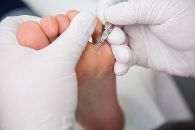 podiatrist ( chiropodist ) temizlik kadın ayakları ( ayak tırnakları )