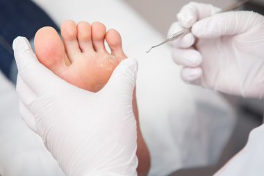 podiatrist ( chiropodist ) temizlik kadın ayakları ( ayak tırnakları )