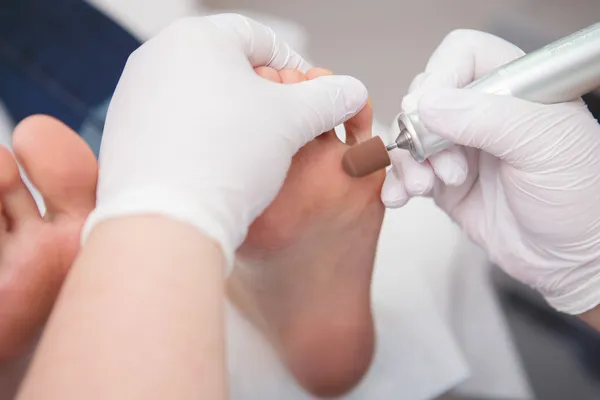 Podólogo (quiropodista) limpeza mulheres pés (unhas dos pés  ) — Fotografia de Stock