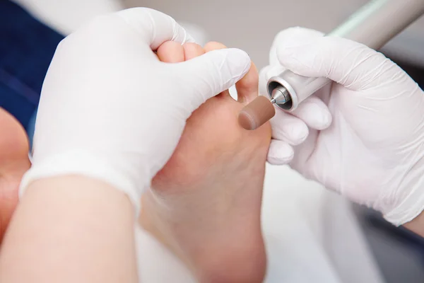 Podiatrist ( chiropodist ) cleaning womans feet ( toenails ) — Stock Photo, Image