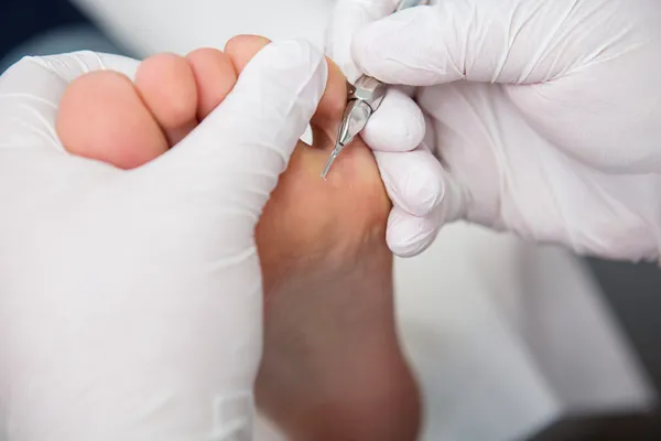 Podiatrist ( chiropodist ) cleaning womans feet ( toenails ) — Stock Photo, Image