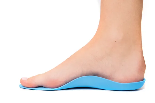 Flat foot isolated on white — Stock Photo, Image
