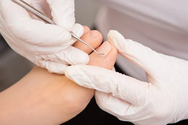 Podiatrist ( chiropodist ) cleaning womans feet — Stock Photo, Image