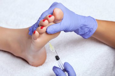 There is a woman's foot, a cosmetologist is making intramuscular injections of on the feet of a woman against hyperhidrosis in a beauty salon.