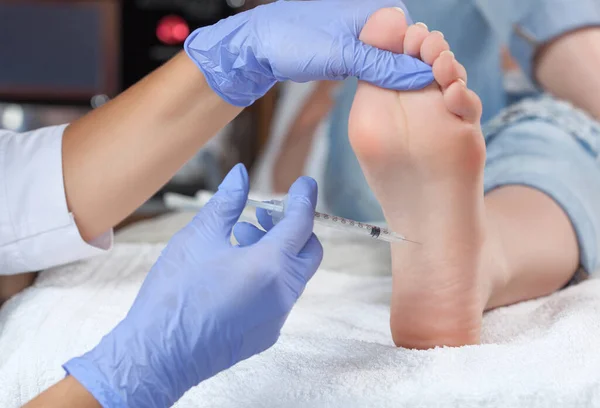 Doktor, kadının ayaklarında hiperhidroza karşı botulinyum iğnesi yapıyor..