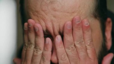 Sakallı bir adam üzgün bir şekilde kameraya bakar ve elleriyle gözlerini ovuşturur, statik kamera, yüzüne yakın çekim.