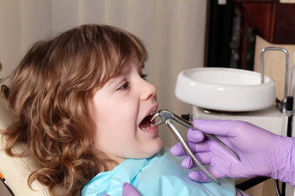 Dentista extrajo el diente niña — Foto de Stock