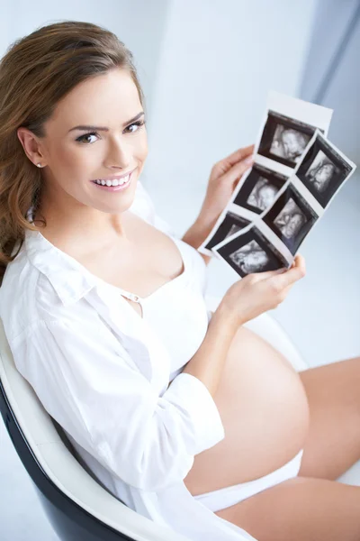 Mujer embarazada sosteniendo sus fotos USG —  Fotos de Stock