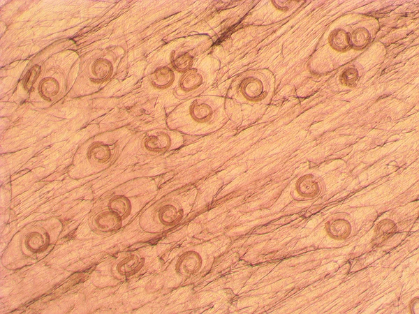 Trichinella spiralis - microscópio parasitário de vermes — Fotografia de Stock