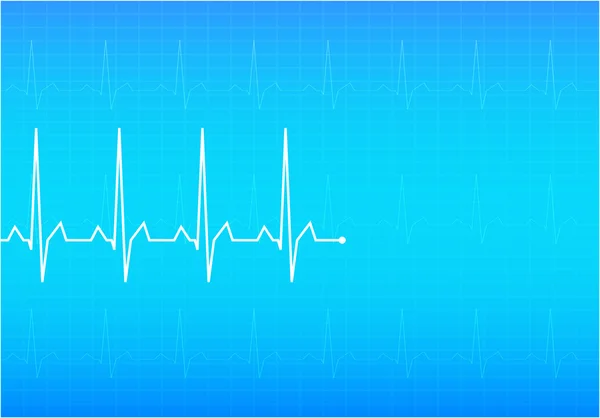 EKG, elektrokardiogram, vektor — Stock vektor